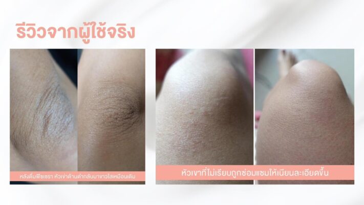 รีวิวผู้ใช้จริง Pecera Complex พีซเซราคอลลาเจน